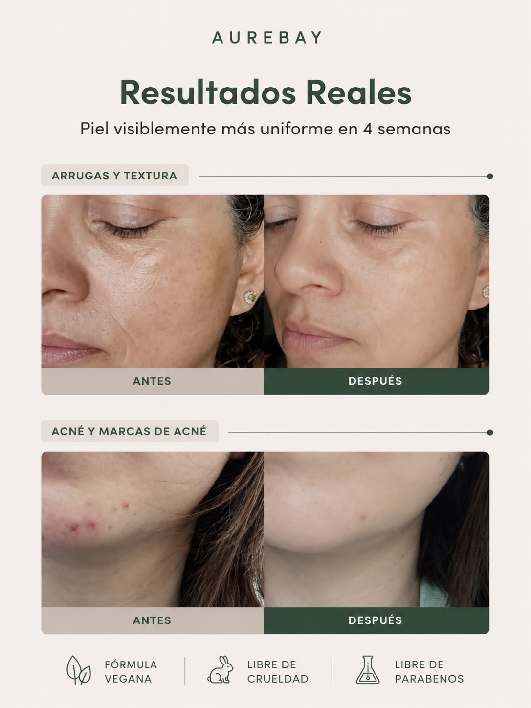 Age Reset Retinol 0.1 Cream 30ml